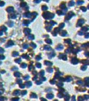 PCBP1 antibody