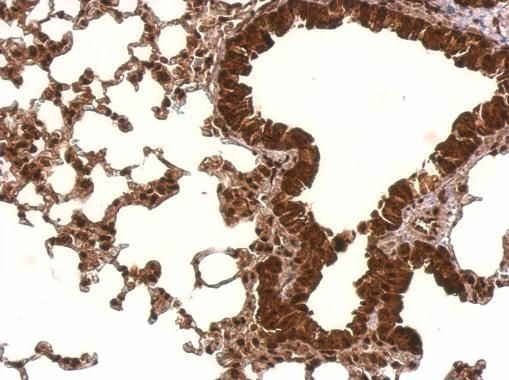 PCBP2 antibody [N1C1]