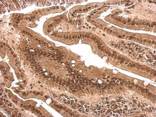 PCBP2 antibody [N1C1]