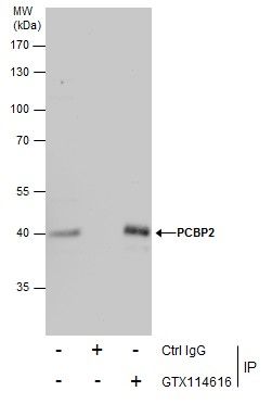 PCBP2 antibody