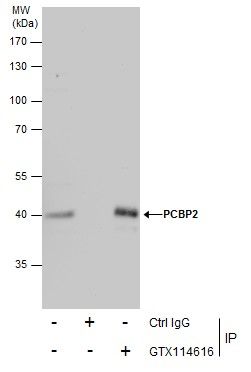 PCBP2 antibody [N1C1]