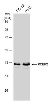 PCBP2 antibody [N1C1]
