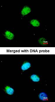 PCBP2 antibody