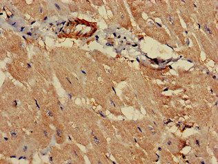 PCCA Antibody
