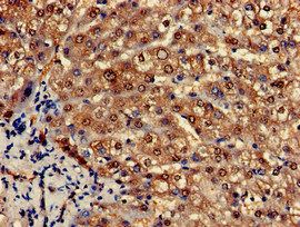 PCCA Antibody