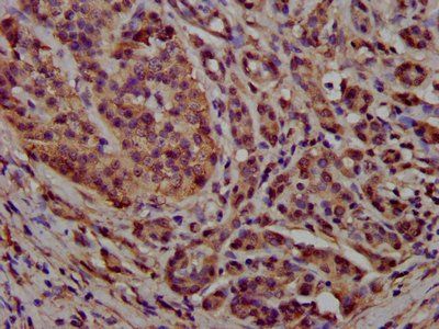 PCCB Antibody
