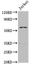 PCCB antibody