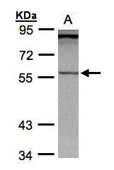 PCCB antibody