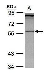 PCCB antibody [N2C3]