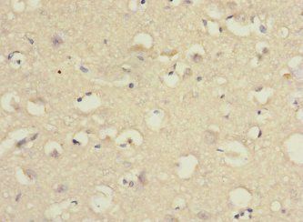 PCDH10 Antibody