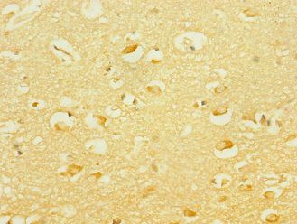 PCDH19 Antibody