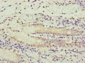 PCDHA12 Antibody