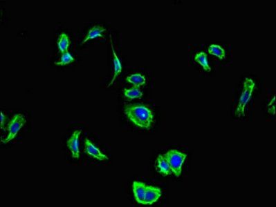 CNR2 Antibody