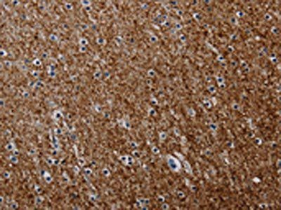 PCDHAC1 Antibody