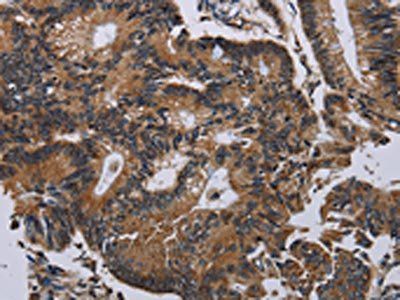 PCDHAC1 Antibody