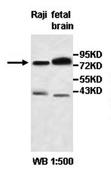 PCDHB11 Rabbit Polyclonal Antibody