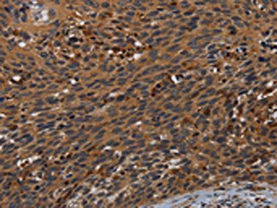 PCDHB15 Antibody
