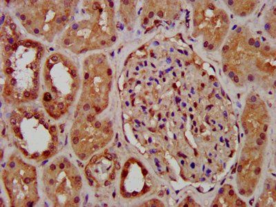 PCGF1 Antibody