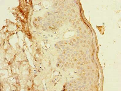 PCIF1 antibody