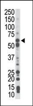 PCK1 antibody