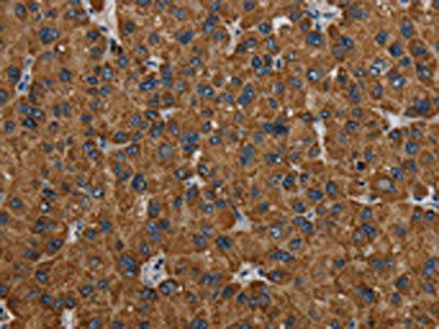 PCK2 Antibody