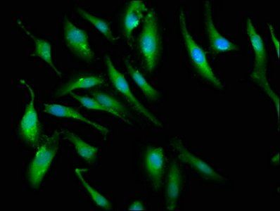 PCMT1 antibody