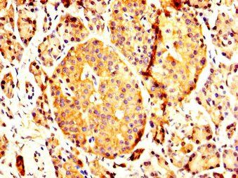 PCMT1 Antibody