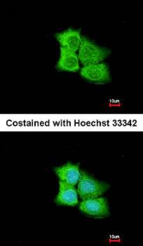 PCMT1 antibody