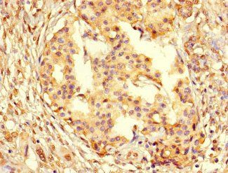 PCNA Antibody