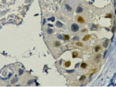 PCNA Monoclonal Antibody
