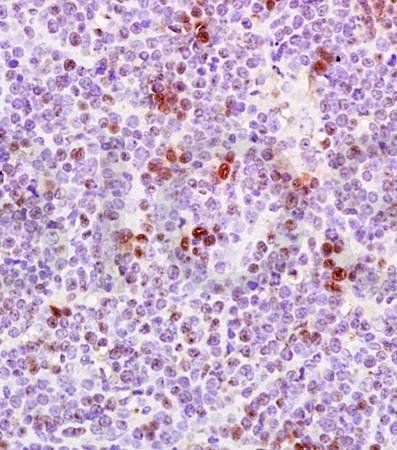 PCNA Rabbit Polyclonal Antibody (Nuclear Loading Control)