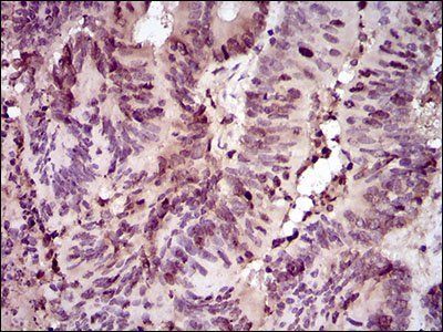 PCNA Antibody