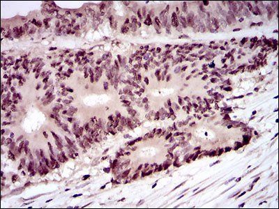 PCNA