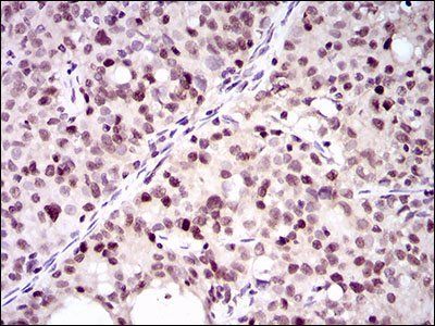 PCNA