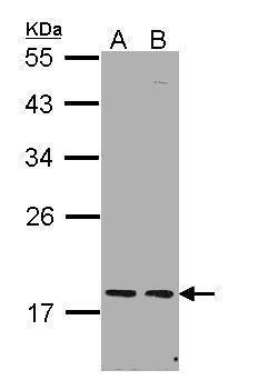PCNP antibody [N1N2], N-term