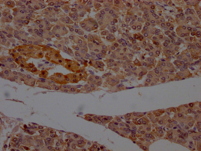 PCNT Antibody