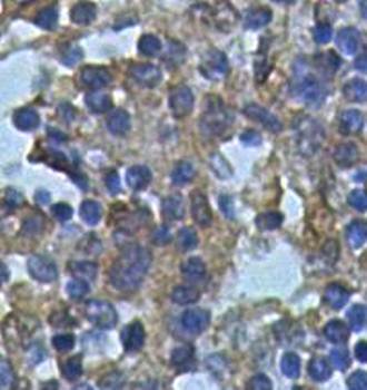 PCSK5 Rabbit Polyclonal Antibody