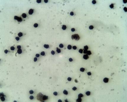 Rabbit Human Proprotein convertase subtilisin/kexin type 9 (PCSK9), NARC1 Antibody