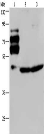 PCSK9 Antibody
