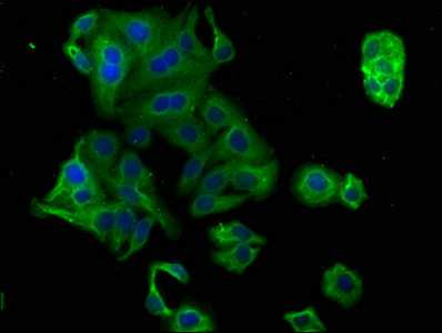 PCSK9 Antibody