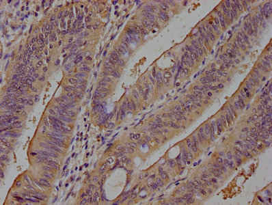 PCSK9 Antibody