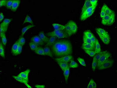 PCSK9 antibody