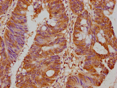 PCSK9 antibody