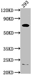 PCSK9 Antibody