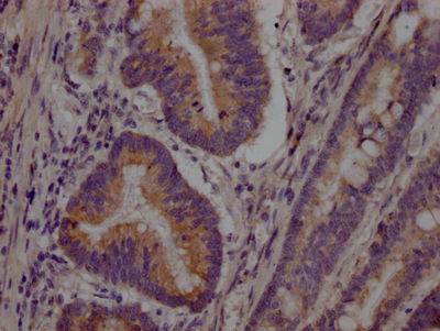 PCSK9 Recombinant Monoclonal Antibody