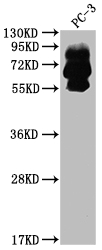 PCSK9 antibody