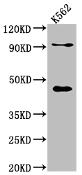 PCYT1A antibody