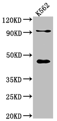 PCYT1A Recombinant Monoclonal Antibody