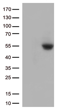 PD-L1 Antibody