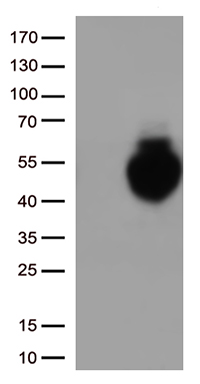 PD-L1 Antibody